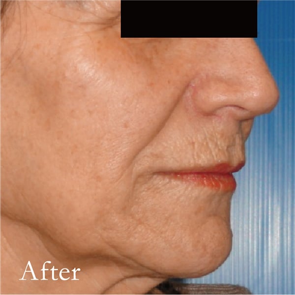 美容皮膚科 あい皮膚科クリニック 宇都宮市東峰町の皮膚科 アレルギー科 美容皮膚科