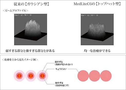 均一な照射