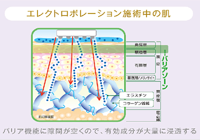 エレクトロポレーション施術中の肌