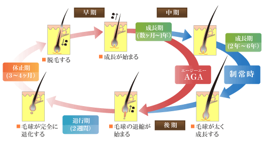 AGAの原因