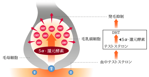 AGAの治療法