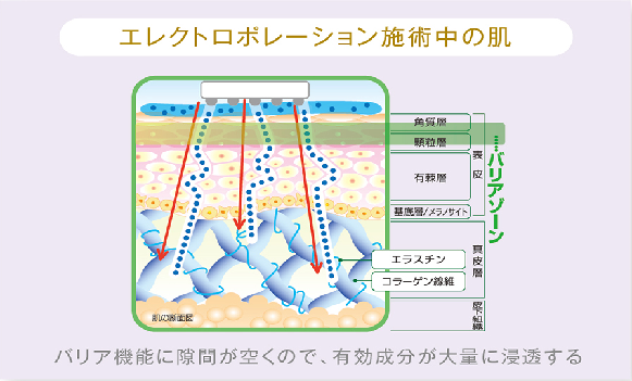 エレクトロポレーション施術中の肌