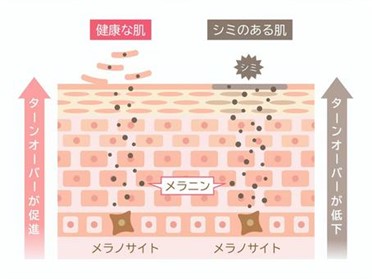 ✿トレチノインの3つの効果✿